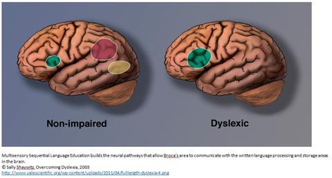 Musical Dyslexia